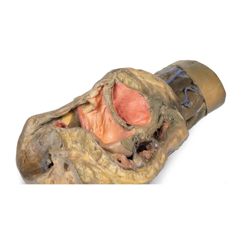 3D Printed Female Hemipelvis and Thigh