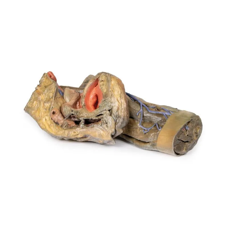 3D Printed Female Hemipelvis and Thigh