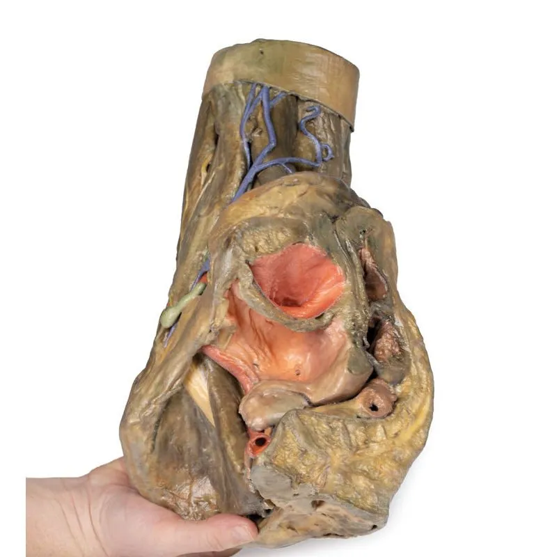 3D Printed Female Hemipelvis and Thigh