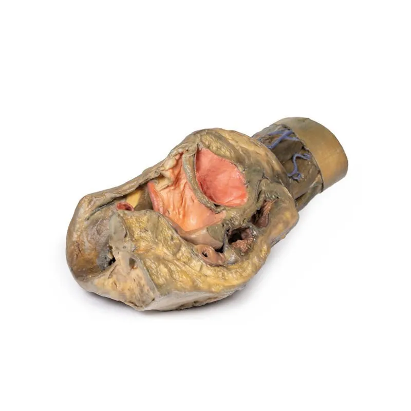 3D Printed Female Hemipelvis and Thigh