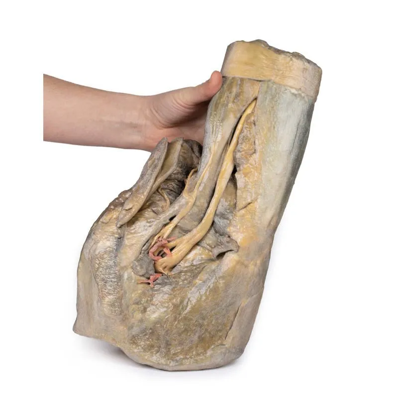 3D Printed Female Hemipelvis and Thigh