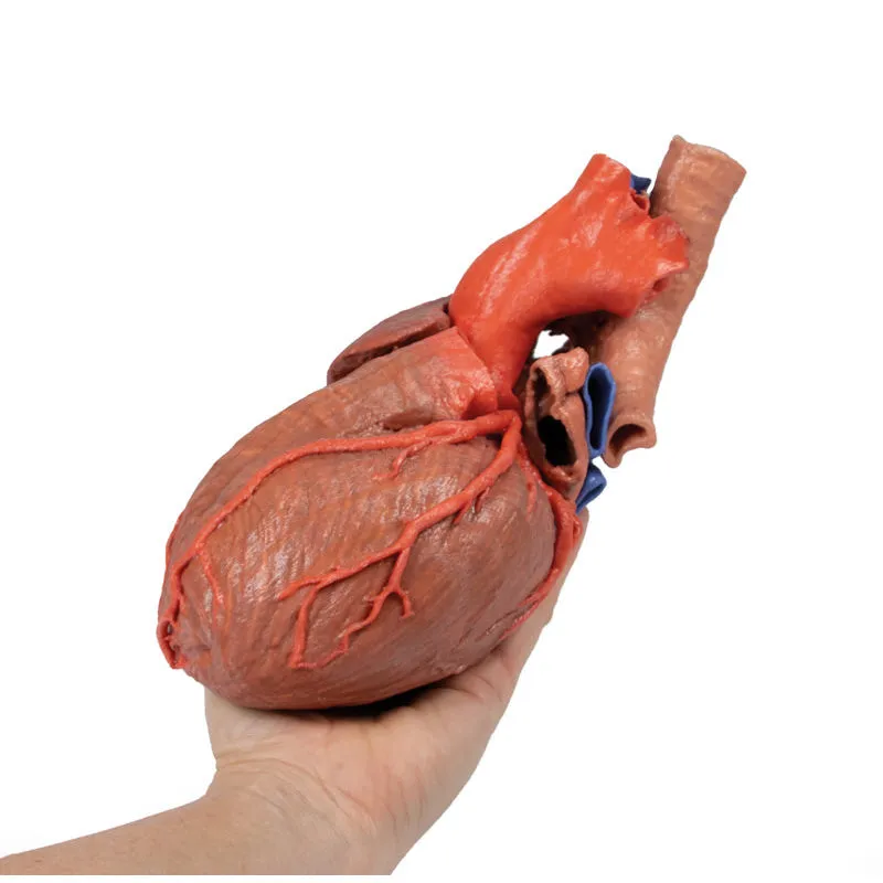3D Printed Heart and the distal trachea, carina and primary bronchi