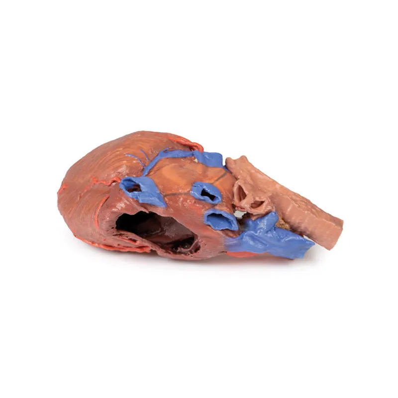 3D Printed Heart and the distal trachea, carina and primary bronchi