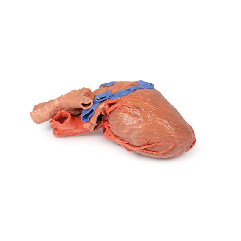 3D Printed Heart and the distal trachea, carina and primary bronchi