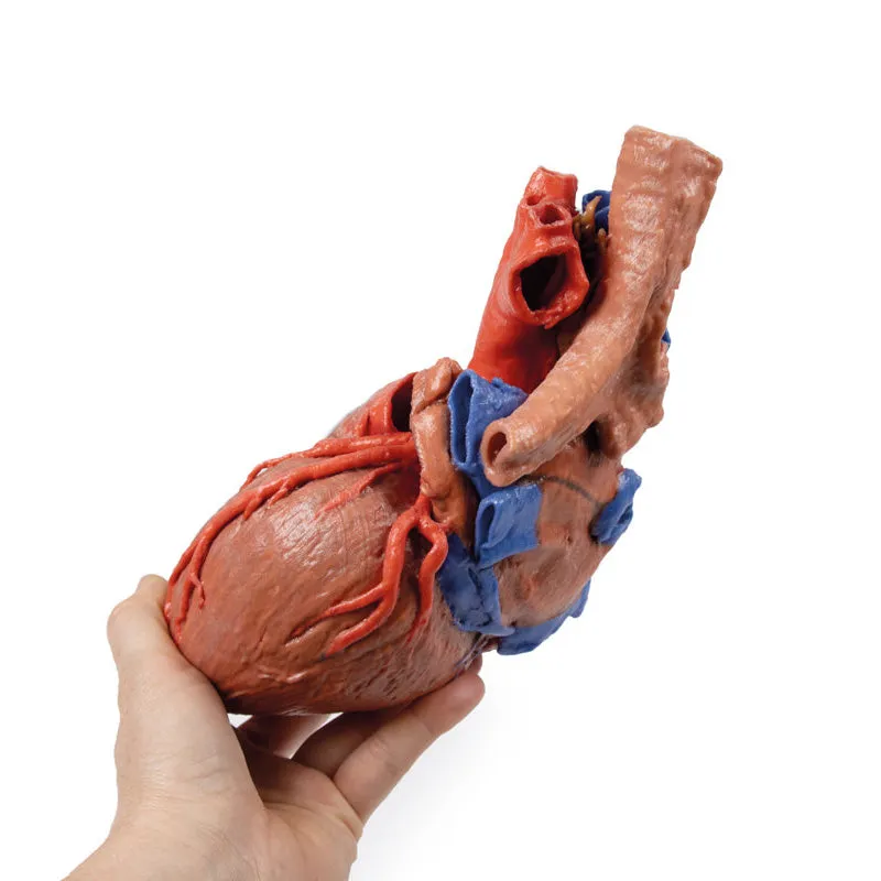 3D Printed Heart and the distal trachea, carina and primary bronchi