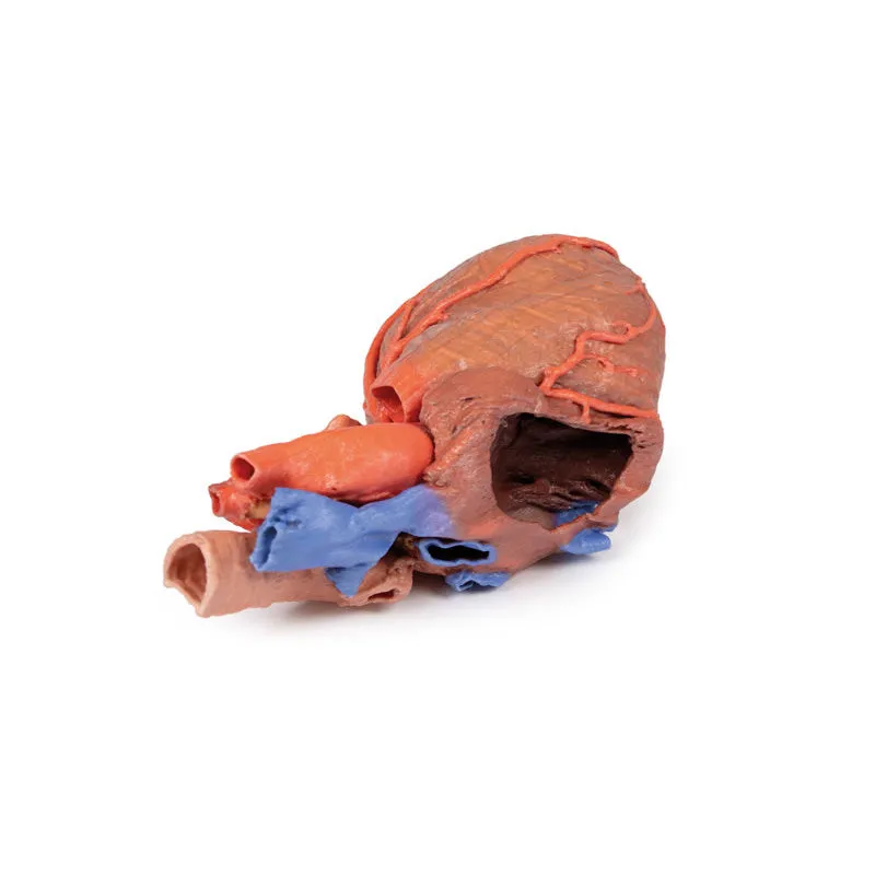 3D Printed Heart and the distal trachea, carina and primary bronchi