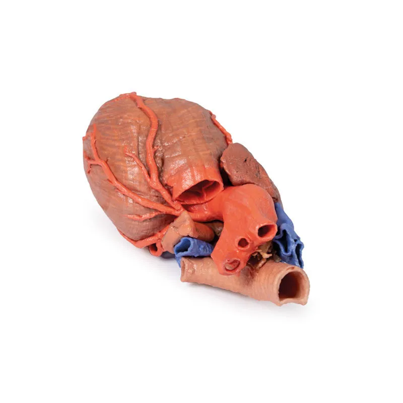 3D Printed Heart and the distal trachea, carina and primary bronchi
