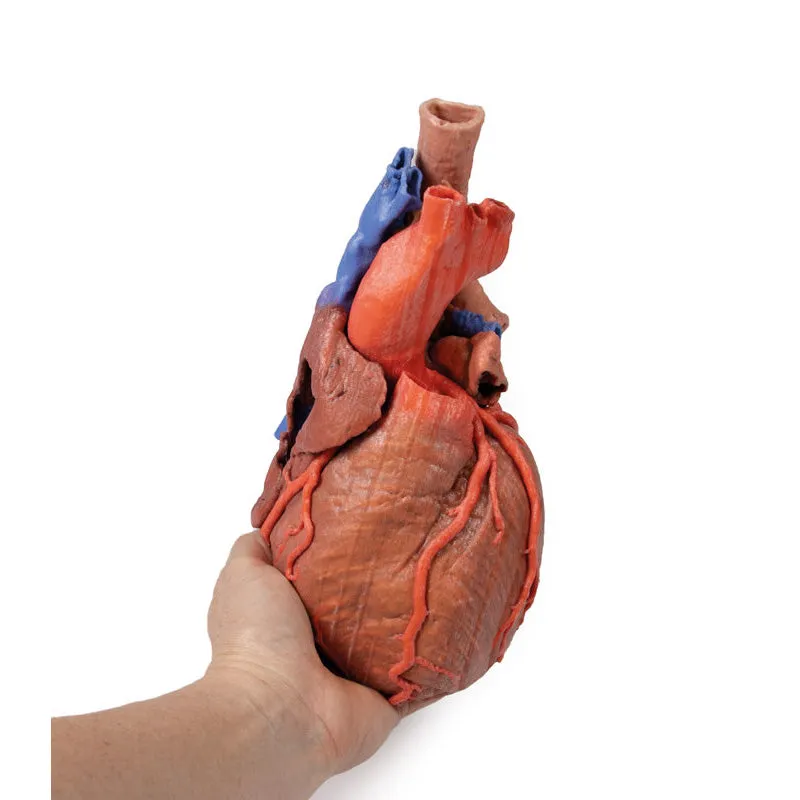 3D Printed Heart and the distal trachea, carina and primary bronchi